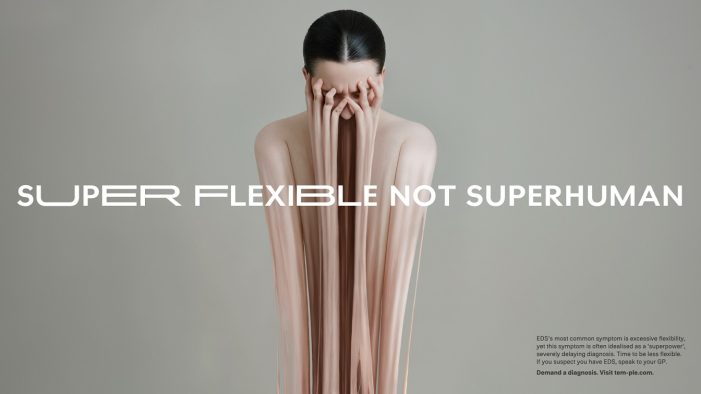 The invisible suffering of Ehlers-Danlos patients visualised in new campaign by WMH&I